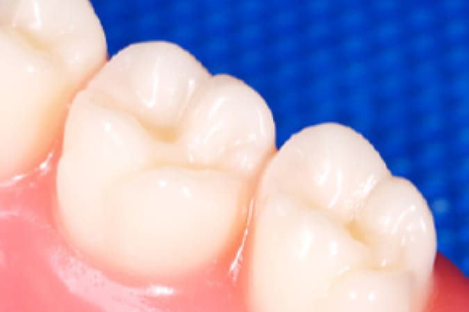 歯周病を知っていますか？